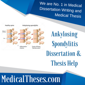 Ankylosing Spondylitis Dissertation & Thesis Help